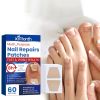 Nail Repair Patches Toenail Fungus Patch Sticky Toenail Care Nail Ingrown Correction Sticker Paronychia Nail Treatment Patch
