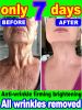 20 years younger, 100% wrinkles disappear