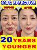 20 years younger, 100% wrinkles disappear